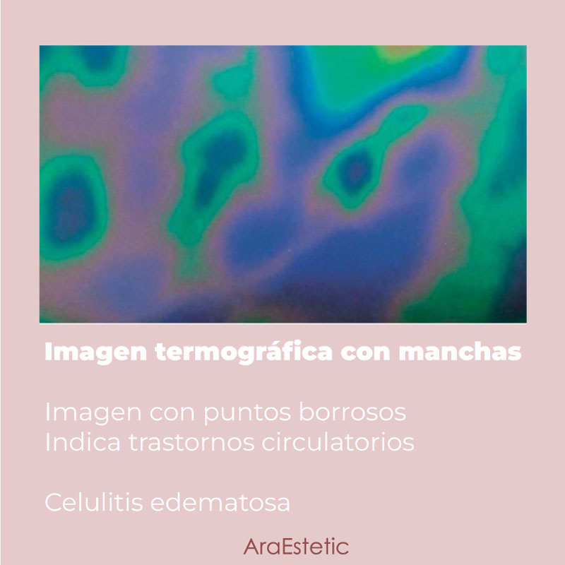 Bandas termográficas